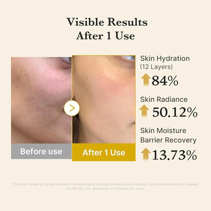 [Medicube] Kojic Acid Turmeric Vita Jelly Mist Serum