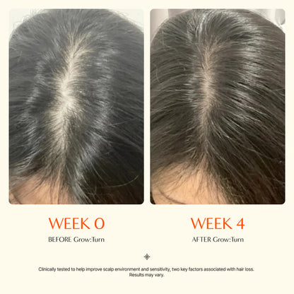 [Lilyeve] Growturn Hair Serum with Brush
