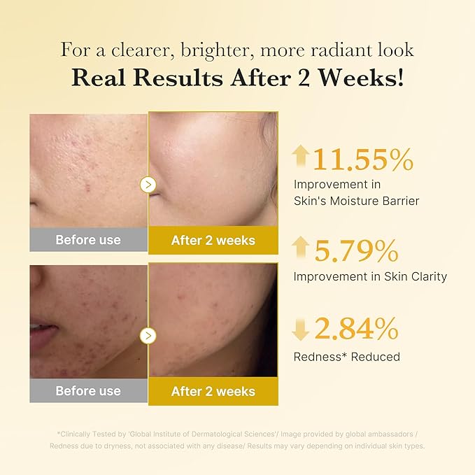 [Medicube] Kojic Acid Turmeric Niacinamide Serum