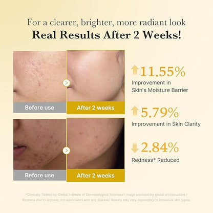 [Medicube] Kojic Acid Turmeric Niacinamide Serum