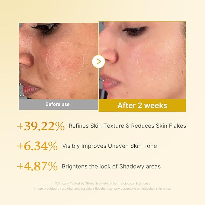 [Medicube] Kojic Acid Turmeric Resurfacing Toner