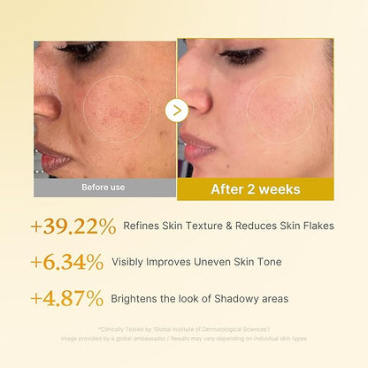 [Medicube] Kojic Acid Turmeric Resurfacing Toner