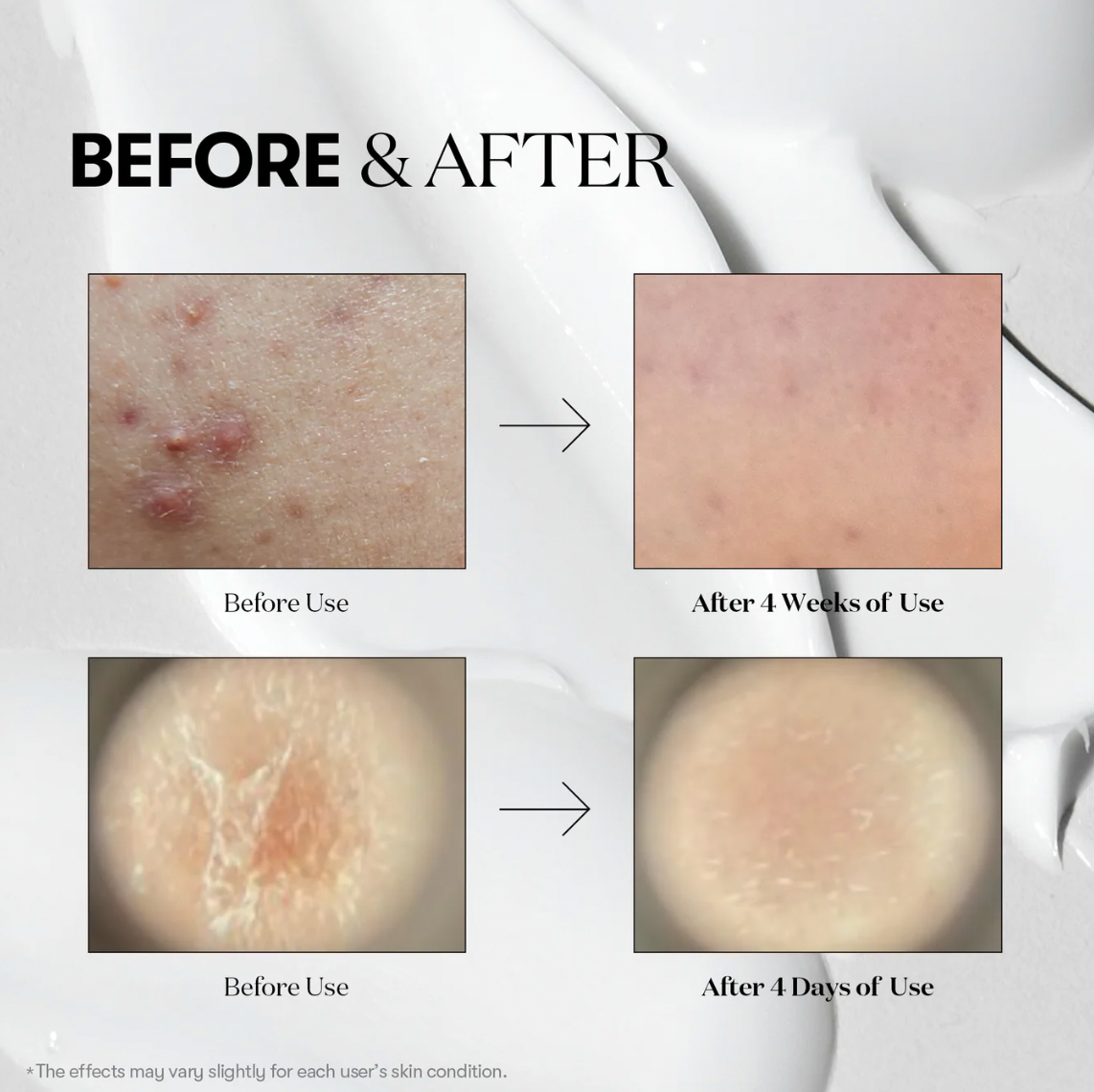 [VT COSMETICS] Cica Reedle Shot 300 Essence