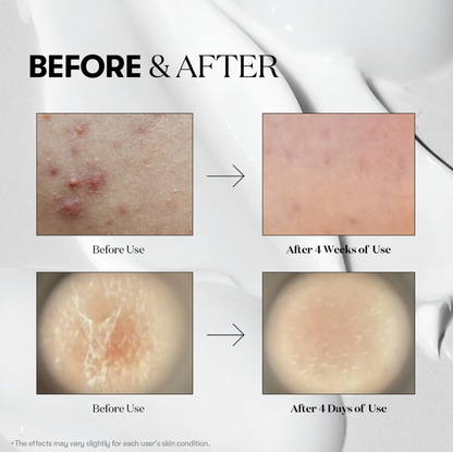 [VT COSMETICS] Cica Reedle Shot 300 Essence