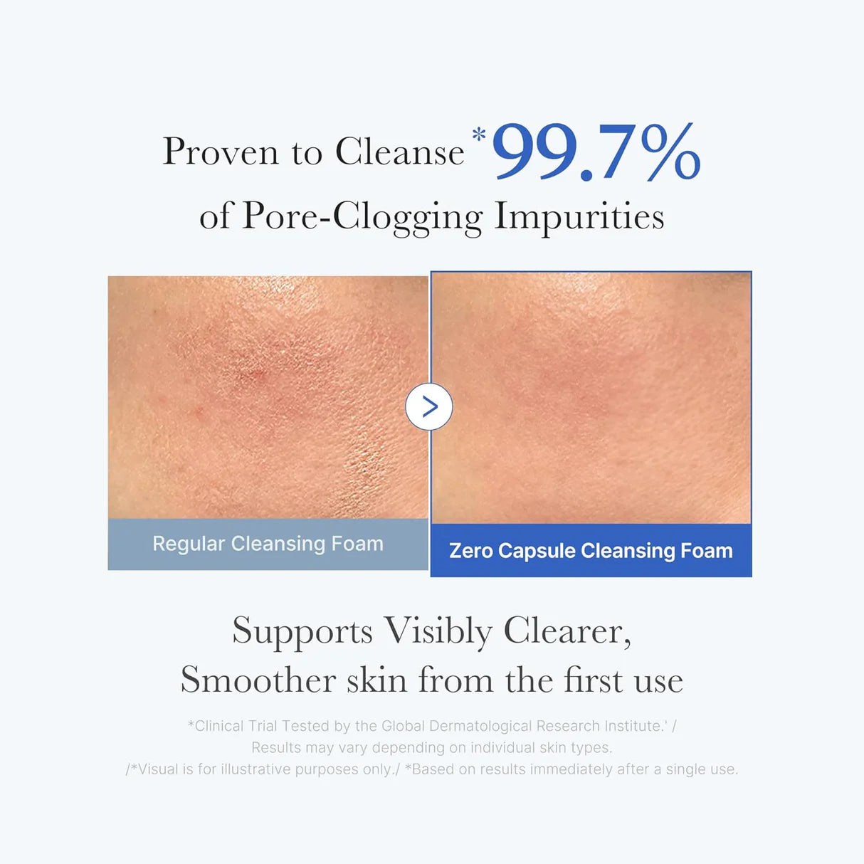 [Medicube] Zero Pore Clearing Capsule Cleansing Foam