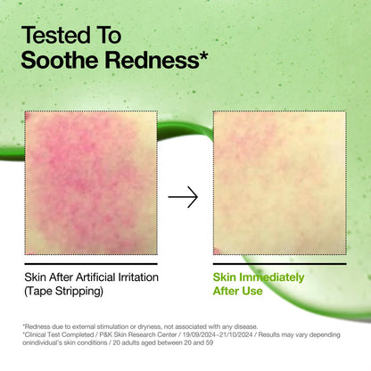 [Anua] Azelaic Acid 10 Hyaluron Redness Soothing Serum