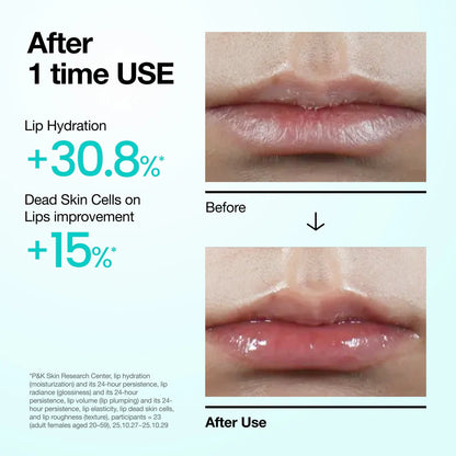 [Anua] PDRN Lip Serum